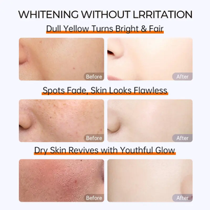 Crème éclaircissante pour le visage 377, éliminateur de taches brunes, hydratante, unifie le teint, produit de soin du visage pour un éclat radieux - Product Image 2