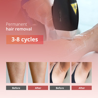2025 Titanium Diode Laser Hair Removal 755 808 830 940 1064nm 800W -2000W Commercial Intelligence Laser Machine USA bar