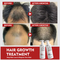 Shampooing et après-shampoing activateur de follicules AHK-CU Copper Tripeptide-3 de qualité clinique, stoppe la chute des cheveux, favorise la repousse, soin du cuir chevelu
