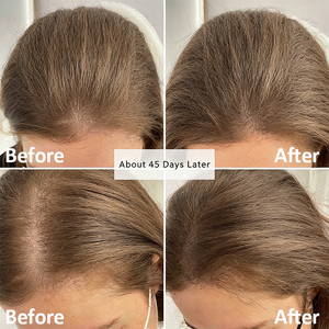 OEM ODM RENEW FORTIFY Black Sesame Ginger Gel <b>Shampoo</b> 330ml Ginseng Anti-Hair Loss Refreshing Nourishing Formula Normal Dry for - Product Image 4