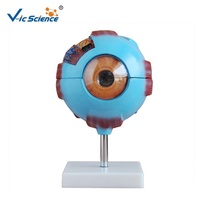 Œil géant modèle anatomie modèles anatomiques yeux oeil orbital modèle de structure anatomique