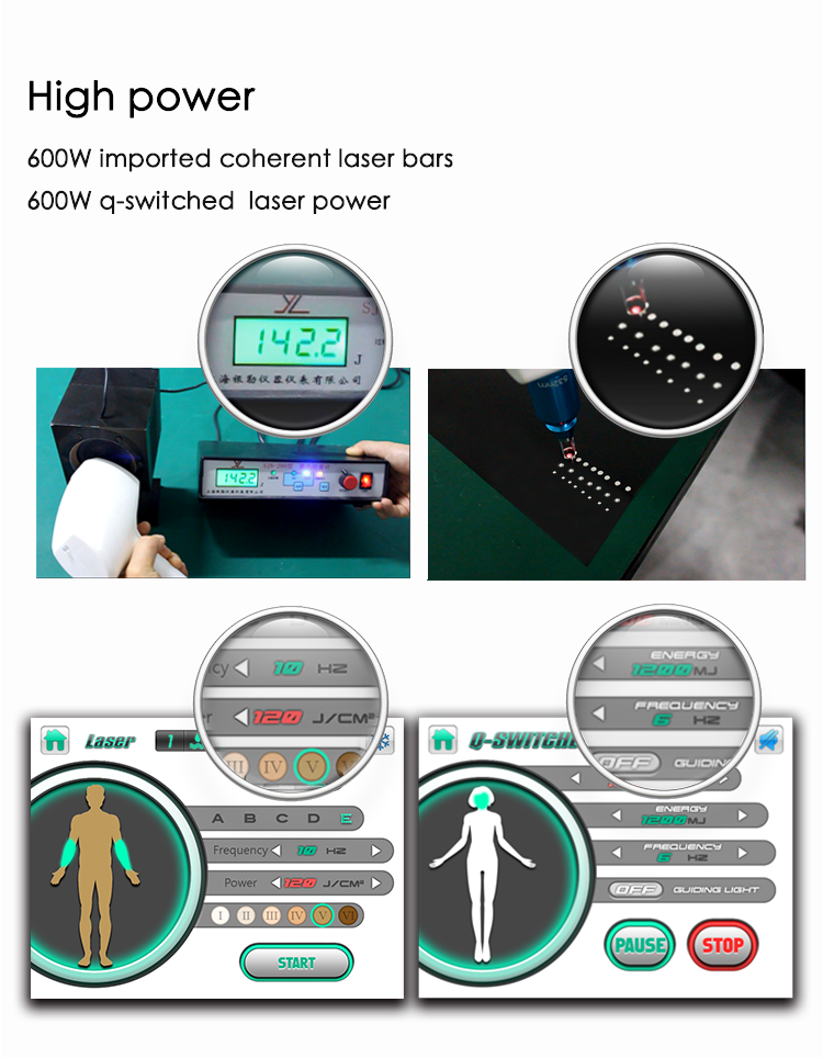 Diode Laser Hair Removal Machine Nd Yag Laser Tattoo Removal Multifunctional