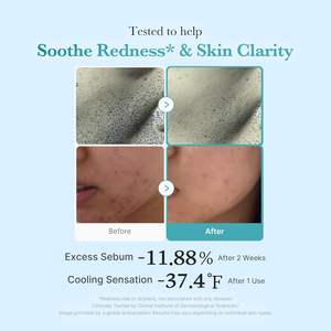 Tónico Facial Medicube con Ácido Azelaico y Niacinamida al 4%, 250 ml, para el Cuidado de la Piel con Problemas - Product Image 4