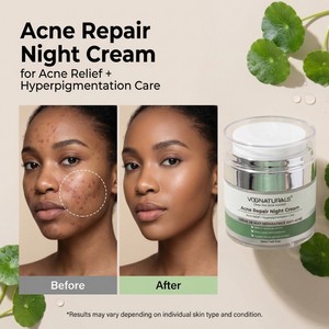 Crème de Jour et de Nuit OEM à la Centella Asiatica, Soins Coréens à l'<span class=keywords><strong>Acide</strong></span> <span class=keywords><strong>Salicylique</strong></span> Apaisant et Hydratant pour la <span class=keywords><strong>Peau</strong></span> - Product Image 4