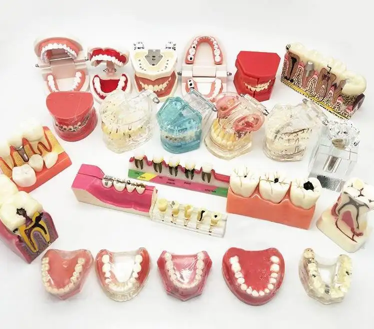 Tooth model dentistry teaching teeth standard denture tooth model mold doctor-patient communication oral decoration
