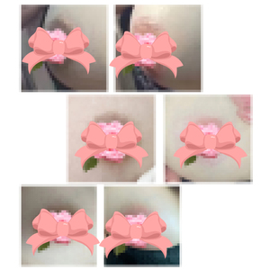 स्त्री रोग विज्ञान के उपयोग के लिए योनि और गुदा ब्लीचिंग क्रीम के साथ गुलाबी त्वचा देखभाल - Product Image 4