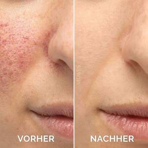 <span class=keywords><strong>Precio</strong></span> de fábrica 30ml <span class=keywords><strong>Suero</strong></span> facial de vitamina C Apriete y mejore la opacidad Solución en stock de esencia de vitamina C - Product Image 6