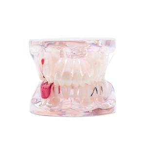Gelsonlab HSDT-C8 Mixte Clair avec dents manquantes modèle de Dents Dentaires Pathologie Modèle D'étude Démonstration Modèle D'enseignement - Product Image 2