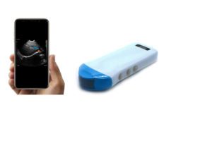 Konted MDR Diagnóstico Cor Sem Fio Micro Convexo C10RS Portátil para Emergência Médica - Product Image 2