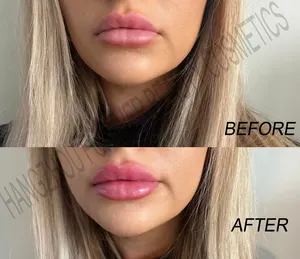 Lip gloss Anbieter benutzer definierte natürliche vegane pralle Lippen praller Glanz