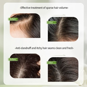 Nhãn hiệu riêng Biotin axit amin dầu gội 500ml/16.9 floz cho tóc tăng trưởng tỏa sáng sâu sửa chữa nuôi dưỡng tóc tăng cường dầu gội - Product Image 5