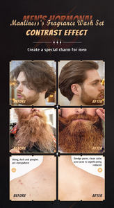 Débloquer plus de <span class=keywords><strong>shampoing</strong></span> à base de plantes pour hommes et meilleur shampooing de croissance pour hommes - Product Image 6