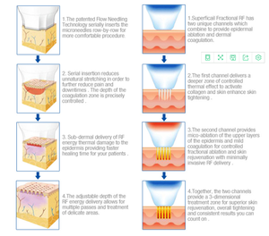 Machine à micro-aiguilles rf la plus populaire serrant la peau machine à micro-aiguilles fractionnaire rf <span class=keywords><strong>prix</strong></span> de vente bas - Product Image 3