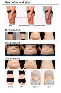 Presso therapie Ganzkörper Presoterapia Profession elles Lymph drainage gerät Fuß <span class=keywords><strong>massage</strong></span> gerät Druck <span class=keywords><strong>massage</strong></span> anzug - Product Image 6