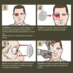 Parche convexo Parche transparente para ojos Protector ocular de metal Cirugía de cataratas Protector ocular de aluminio con cubierta de tela - Product Image 3