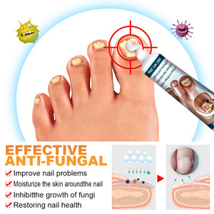 Tratamiento/Farmacíacos para Hongos en las Uñas Kanyehb, Pasta para Eliminar el Gris, Comercio Exterior Transfronterizo, Temu, <span class=keywords><strong>Shein</strong></span> - Product Image 6