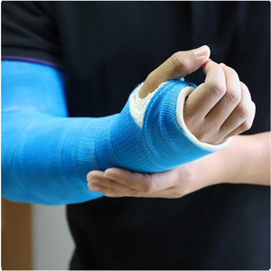 Nastro Ortopedico in Fibra di Vetro a Presa Rapida per Immobilizzazione di Fratture Ossee, Forniture Ospedaliere - Product Image 5