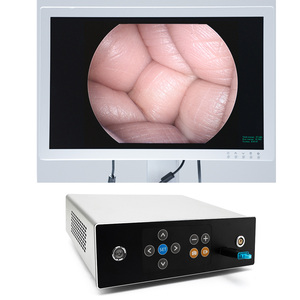 Phẫu thuật nội soi Hệ Thống Camera, xách tay 1080P FHD y tế hệ thống hình ảnh, cứng nhắc nội soi camera cho Ent/laparoscopy/arthroscopy - Product Image 3