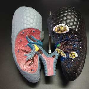 عرض مقارن لموديلات أمراض الجهاز التنفسي البشري بين الرئة المدخنة والرئة الصحية - Product Image 3