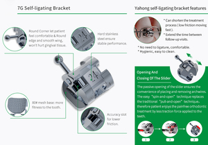 Professional Dental Brackets, Metal Braces, Rapid Correction of Dental Deformities - Product Image 4