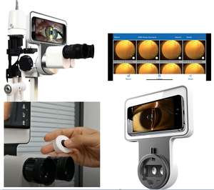 Lampe à fente portable, système de caméra numérique pour lampe à fente, compatible avec les téléphones mobiles Android et iOS - Product Image 1