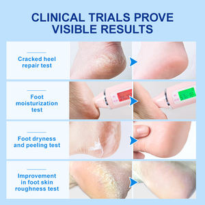 Crème Pieds en Gros à 42 % d'Urée, Meilleure Vente, Crème Réparatrice Bio pour Talons Fendillés à Hydratation Intense - Product Image 6