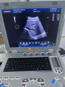 Máquina de Ultrasonido Portátil Profesional Pw Doppler USG 2D 3D al Mejor Precio - Product Image 5