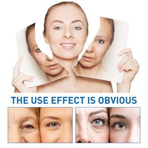 Etiqueta privada <span class=keywords><strong>HYALU</strong></span> <span class=keywords><strong>B5</strong></span> Suero antienvejecimiento Hidratante Ácido hialurónico Cuidado DE LA PIEL Suero facial - Product Image 4