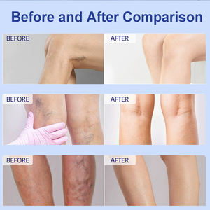 Complément alimentaire à base de plantes à prix d'usine pour les varices, patch naturel qui améliore l'apparence des jambes, soulagement de la douleur, bienfaits hypoallergéniques - Product Image 5