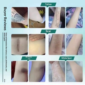 6 Parches Adhesivos Impermeables para Cubrir Tatuajes, Ultrafinos, para Disimular Imperfecciones - Product Image 4