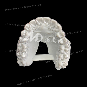 Retainer orthodontique personnalisé pour l'extérieur de laboratoire dentaire – Compatible STL ou modèle dentaire pour laboratoire dentaire (types Hawley, Clear, <span class=keywords><strong>Essix</strong></span>) - Product Image 5