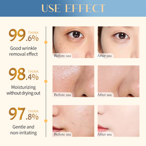 Jabón de Cúrcuma y Jengibre <span class=keywords><strong>para</strong></span> Eliminar Manchas Oscuras, Jabón Facial Orgánico Natural de Cúrcuma, Jabón Vegano de Cúrcuma, Limón y Ácido Kójico - Product Image 5