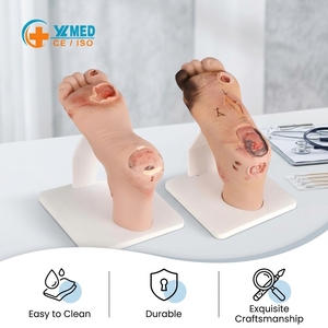 Modelo de pie diabético (leve/severo) para formación médica, maniquí preventivo para el pie diabético, silicona CE/ISO - Product Image 1
