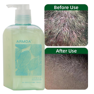Ensemble de shampooings <span class=keywords><strong>sans</strong></span> <span class=keywords><strong>sulfate</strong></span> 250 ml, anti-allergiques, anti-chute, pour soins capillaires, pour cuirs chevelus sensibles - Product Image 3