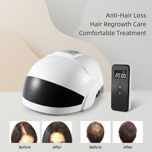 Portable Home Use Smart Hair Growth Cap for Relieving Hair Loss Problems, Used for Scalp Repair and Hair Regeneration Treatment - Product Image 1