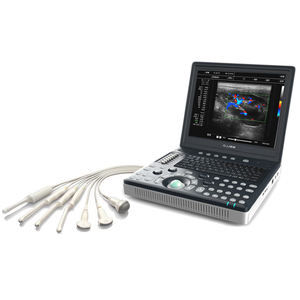 Hoogwaardig draagbaar 2D veterinaire echografie systeem met meerdere probes, milieuvriendelijk - Product Image 6