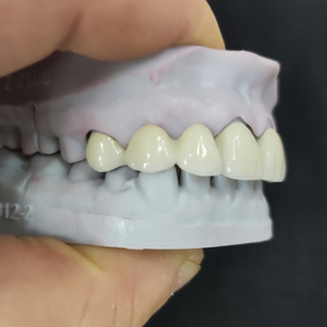<span class=keywords><strong>Dents</strong></span> en zircone personnalisées de laboratoire dentaire numérique en Chine couronne et ponts en zircone solide - Product Image 5