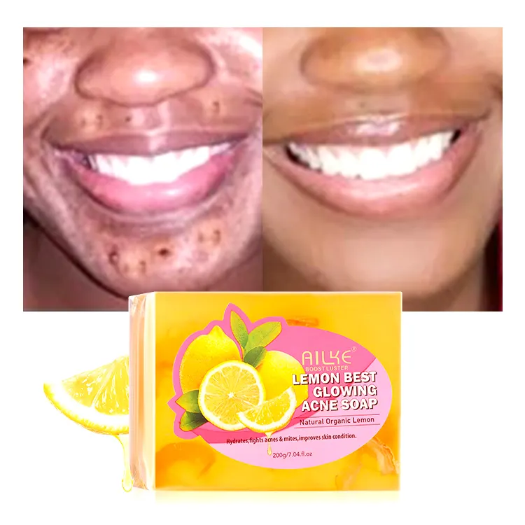 Private Label 200g Organic Alpha Arbutin Skin Glowing Acne Removal Bar Whitening Face Wash Lemon Soap For Black Skin