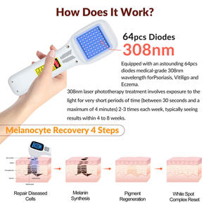 Appareil de luminothérapie UVB 308 nm pour usage domestique, traitement de l'eczéma, du vitiligo, du <span class=keywords><strong>psoriasis</strong></span>, avec des résultats rapides, thérapie cutanée ciblée - Product Image 2