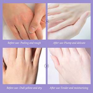 OEM vente en gros lavande masque professionnel de réparation des mains nouveauté liquide anti-âge fissures gants de blanchiment - Product Image 6