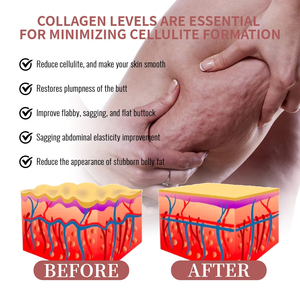 Body Firming <b>Slimming</b> Fat Burning <b>Cream</b> with Vitamin E Massage Shaping Abdomen & Arm Nourishing <b>Skin</b> 30g for Women - Product Image 4