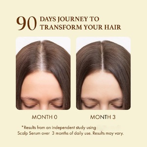 Logo personnalisé sérum de croissance des <span class=keywords><strong>cheveux</strong></span> avec huile de romarin et huile de batana et sérum à la biotine en <span class=keywords><strong>spray</strong></span> pour la croissance des <span class=keywords><strong>cheveux</strong></span> femmes hommes traitement contre la perte de <span class=keywords><strong>cheveux</strong></span> - Product Image 5