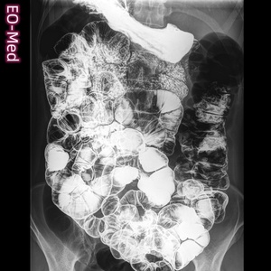 Appareil de radiographie numérique dynamique avec système de fluoroscopie - Product Image 3