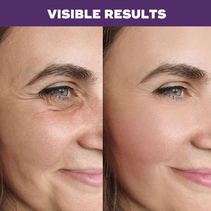 Etiqueta privada Bakuchiol Suero facial Vegano Líquido Fórmula blanqueadora 50ml Antienvejecimiento Levantamiento Eliminación de arrugas Suero facial para aclarar - Product Image 2