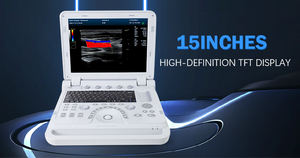 CONTEC CMS1700B 도플러 휴대용 3D 4D 초음파 장비 - Product Image 2