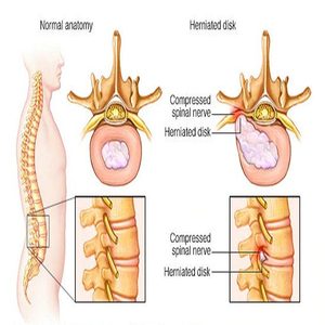 980nm 1470nm Laser dioda Dual wavelepal PLDD operasi cakram Lumbar perangkat Laser operasi medis <span class=keywords><strong>Percutaneous</strong></span> - Product Image 4