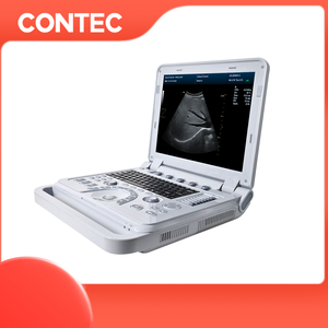 Máquina de <span class=keywords><strong>ecocardiograma</strong></span> CONTEC CMS1700A, ultrasonido <span class=keywords><strong>Doppler</strong></span> portátil - Product Image 2