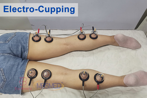 Almohadilla de electrodos Alivio del dolor <span class=keywords><strong>muscular</strong></span> eléctrico Smart Ems Estimulador <span class=keywords><strong>muscular</strong></span> Tens Máquina de electroestimulación - Product Image 4