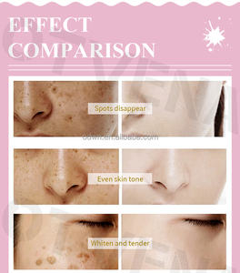 El favorito del cliente Blanqueamiento rápido Corrección de manchas <span class=keywords><strong>Mejor</strong></span> crema justa para la cara - Product Image 4