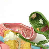 DARHMMY - Modelo Anatómico de Páncreas Patológico para Enseñanza Médica, PVC, Tamaño Real, para Entrenamiento de Médicos, Educación Hospitalaria